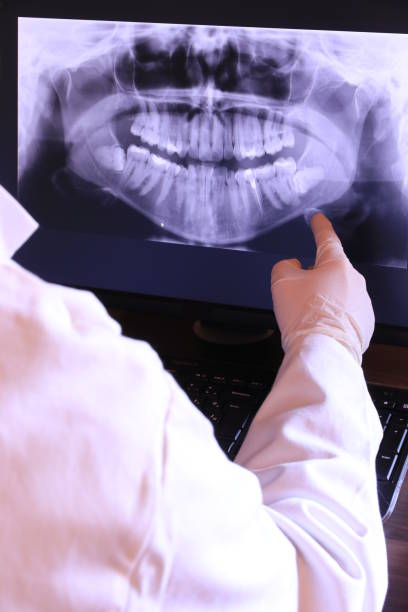 Best Broken or Chipped Tooth Repair in Experiment, GA